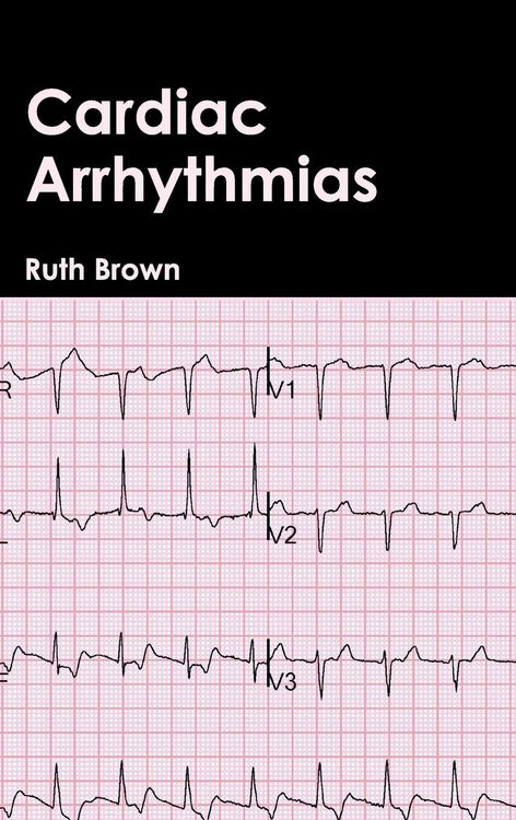 Produktbild: Cardiac Arrhythmias