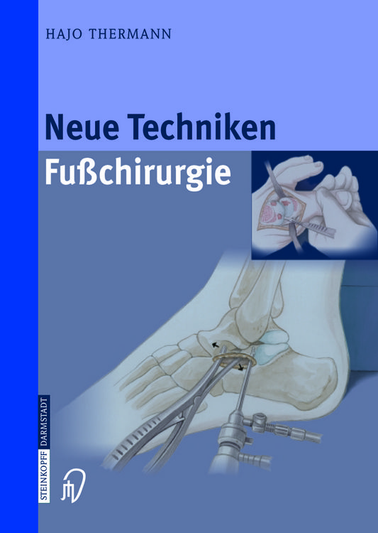 Produktbild: Neue Techniken Fusschirurgie