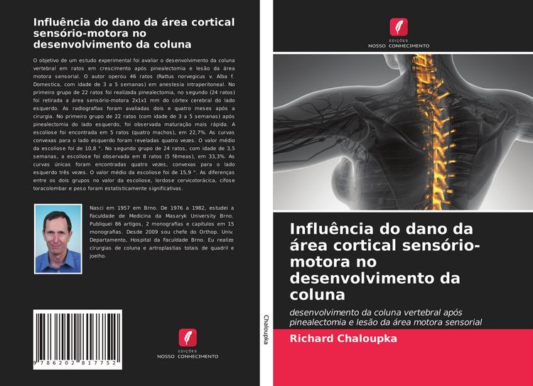 Produktbild: Influ&ecirc;ncia do dano da &aacute;rea cortical sens&oacute;rio-motora no desenvolvimento da coluna