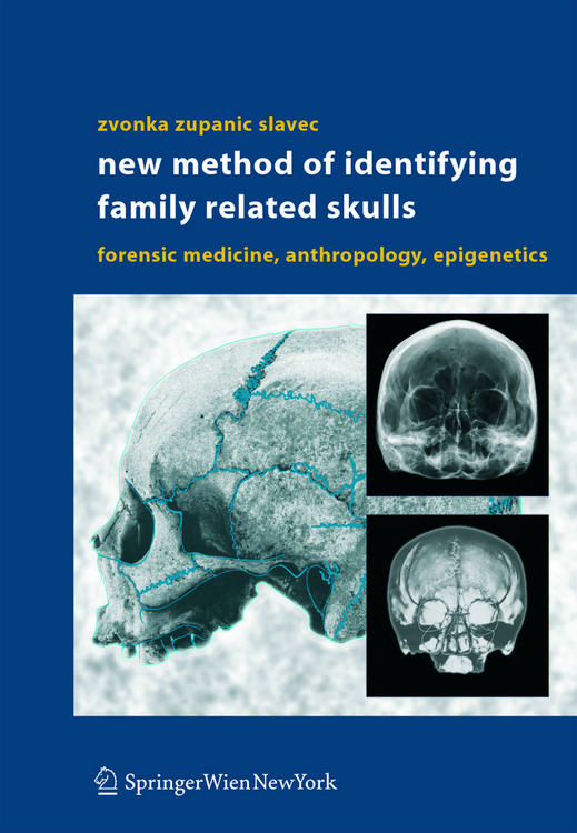 Produktbild: New Method of Identifying Family Related Skulls