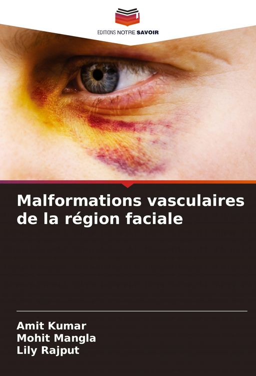 Produktbild: Malformations vasculaires de la r&eacute;gion faciale