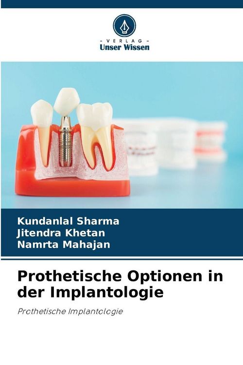 Produktbild: Prothetische Optionen in der Implantologie
