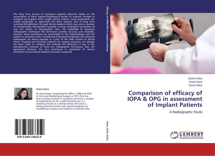 Produktbild: Comparison of efficacy of IOPA & OPG in assessment of Implant Patients