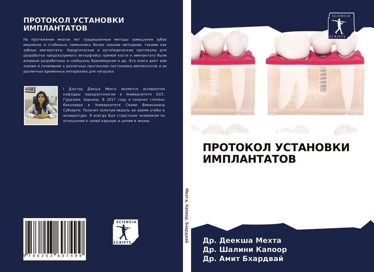 Produktbild: Protokol Ustanovki Implantatov