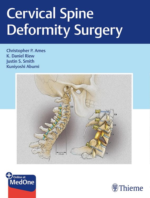 Produktbild: Cervical Spine Deformity Surgery