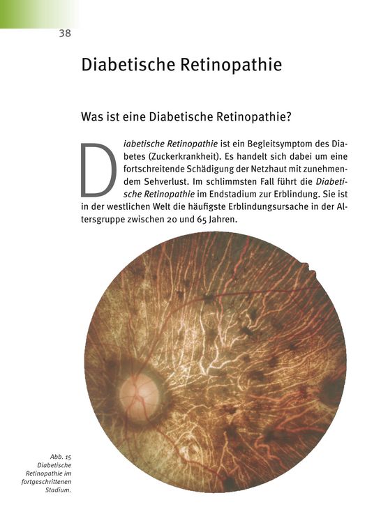 Produktbild: Makuladegeneration - Diabetische Retinopathie