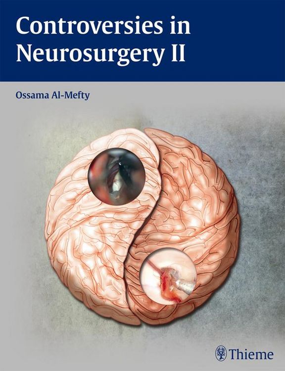 Produktbild: Controversies in Neurosurgery II