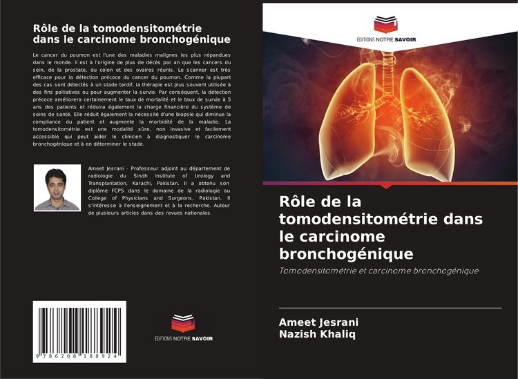Produktbild: R&ocirc;le de la tomodensitom&eacute;trie dans le carcinome bronchog&eacute;nique