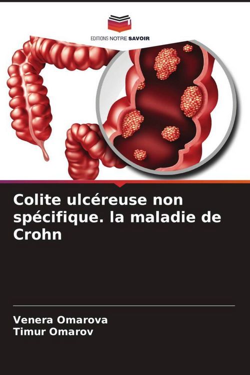 Produktbild: Colite ulc&eacute;reuse non sp&eacute;cifique. la maladie de Crohn