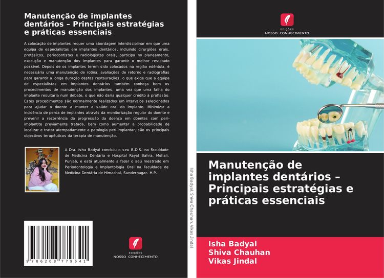 Produktbild: Manuten&ccedil;&atilde;o de implantes dent&aacute;rios - Principais estrat&eacute;gias e pr&aacute;ticas essenciais