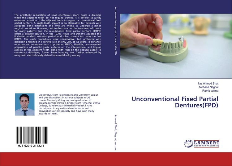 Produktbild: Unconventional Fixed Partial Dentures(FPD)