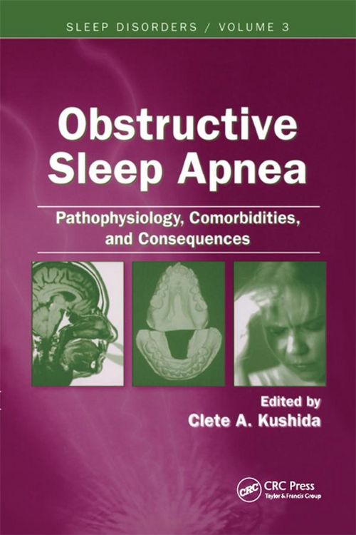 Produktbild: Obstructive Sleep Apnea
