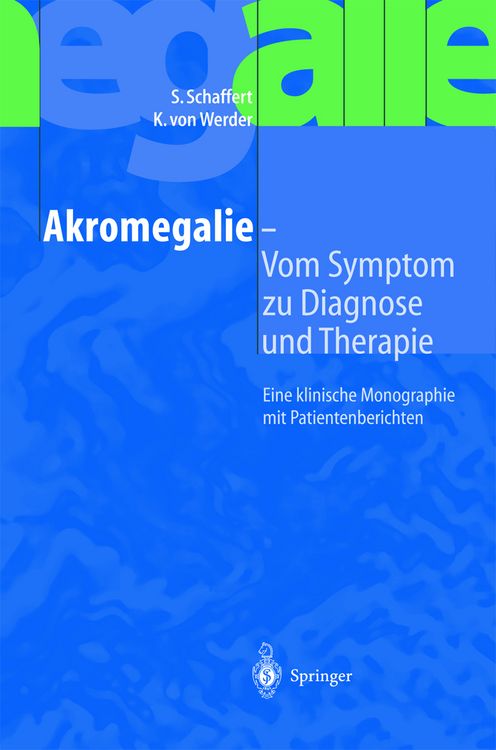Produktbild: Akromegalie &mdash; Vom Symptom zu Diagnose und Therapie