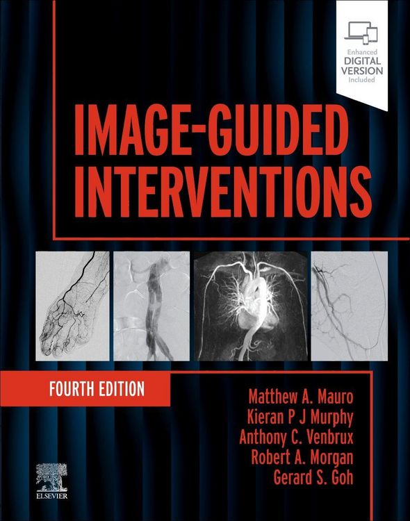 Produktbild: Image-Guided Interventions
