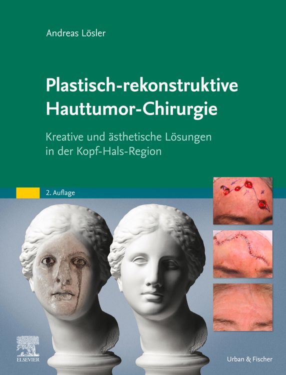 Produktbild: Plastisch-rekonstruktive Hauttumor-Chirurgie