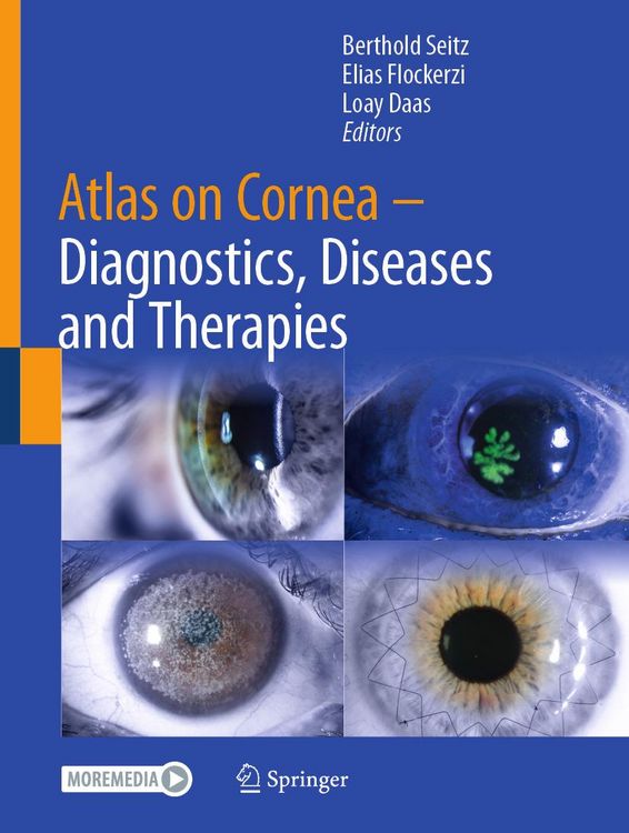 Produktbild: Atlas on Cornea