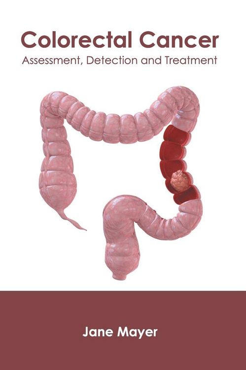 Produktbild: Colorectal Cancer: Assessment, Detection and Treatment