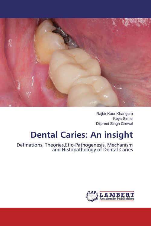 Produktbild: Dental Caries: An insight