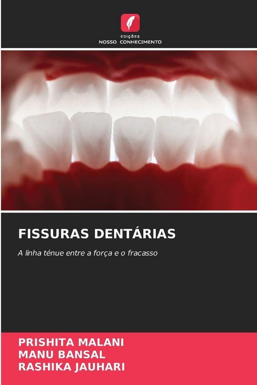 Produktbild: Fissuras Dent&aacute;rias