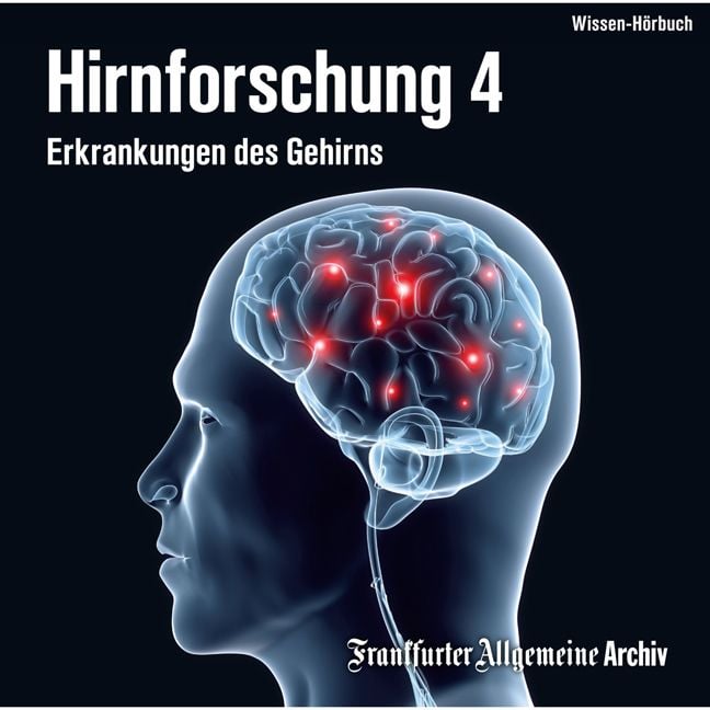 Produktbild: Hirnforschung 4