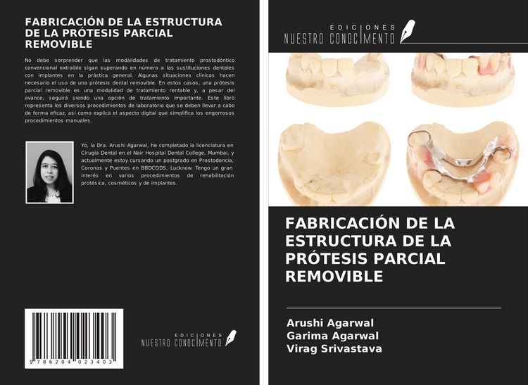 Produktbild: Fabricaci&oacute;n De La Estructura De La Pr&oacute;tesis Parcial Removible