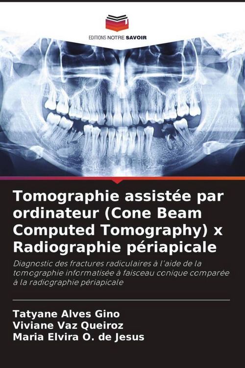 Produktbild: Tomographie assist&eacute;e par ordinateur (Cone Beam Computed Tomography) x Radiographie p&eacute;riapicale