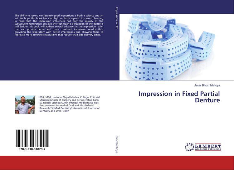 Produktbild: Impression in Fixed Partial Denture