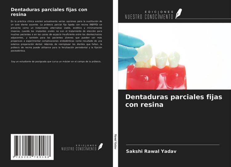 Produktbild: Dentaduras parciales fijas con resina