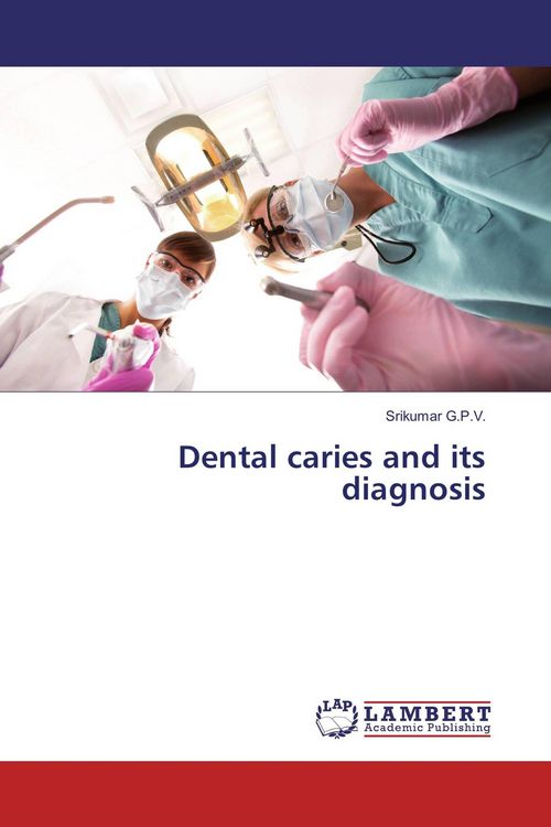 Produktbild: Dental caries and its diagnosis