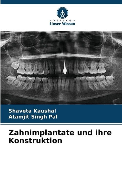 Produktbild: Zahnimplantate und ihre Konstruktion