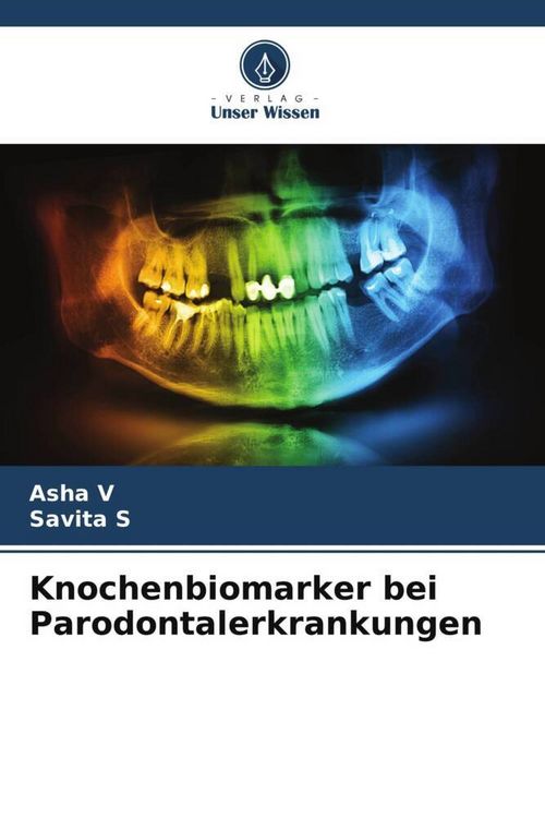 Produktbild: Knochenbiomarker bei Parodontalerkrankungen