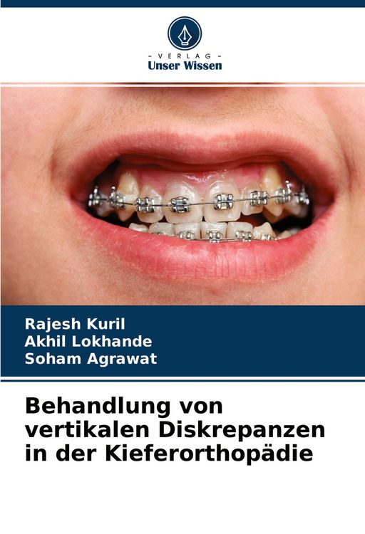Produktbild: Behandlung von vertikalen Diskrepanzen in der Kieferorthop&auml;die