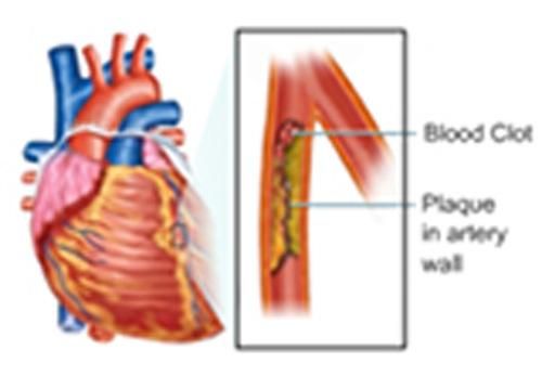 Produktbild: Estimation of Blood Triglycerides