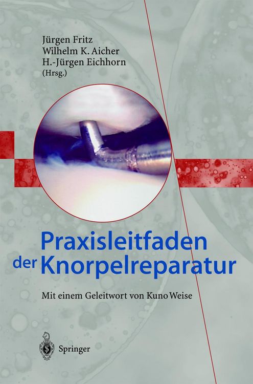 Produktbild: Praxisleitfaden der Knorpelreparatur