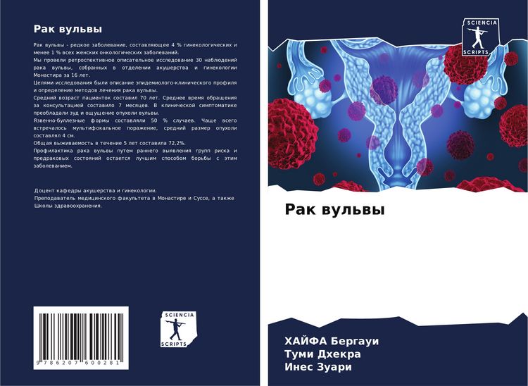 Produktbild: Rak wul'wy