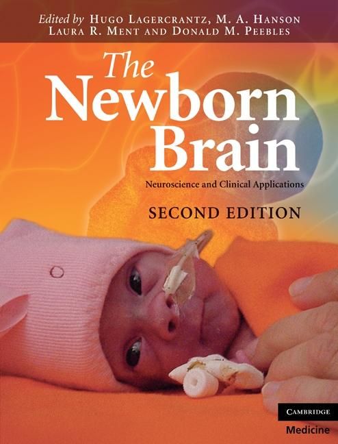 Produktbild: Newborn Brain