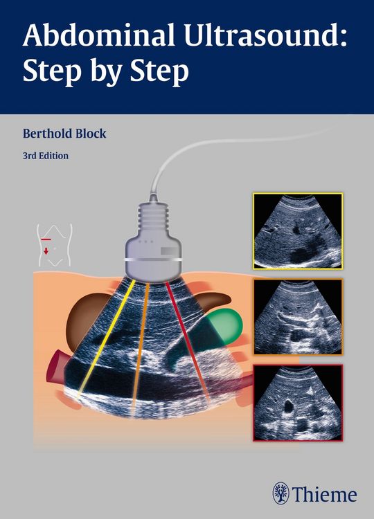 Produktbild: Abdominal Ultrasound: Step by Step
