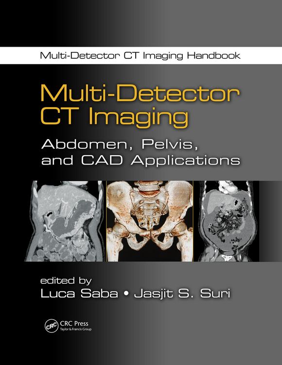 Produktbild: Multi-Detector CT Imaging