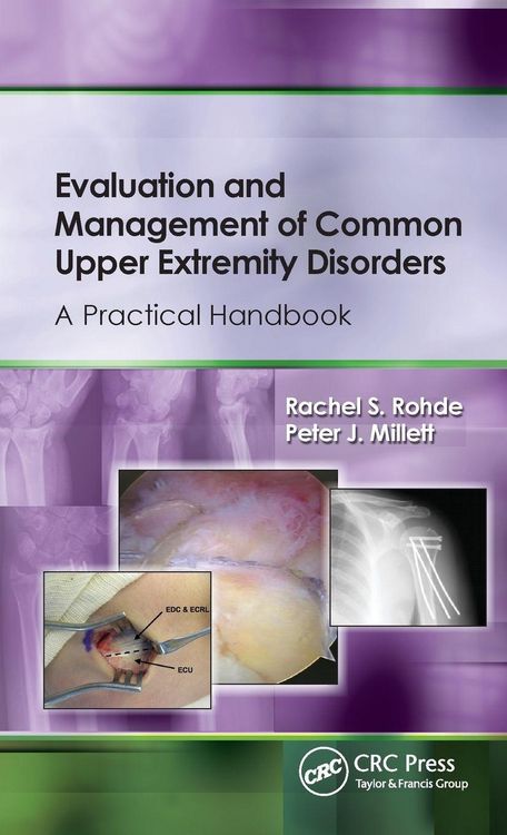 Produktbild: Evaluation and Management of Common Upper Extremity Disorders