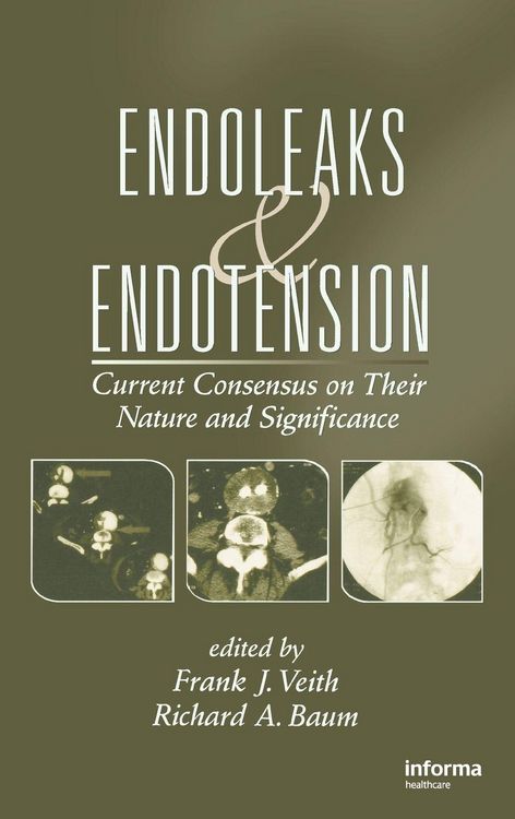 Produktbild: Endoleaks and Endotension