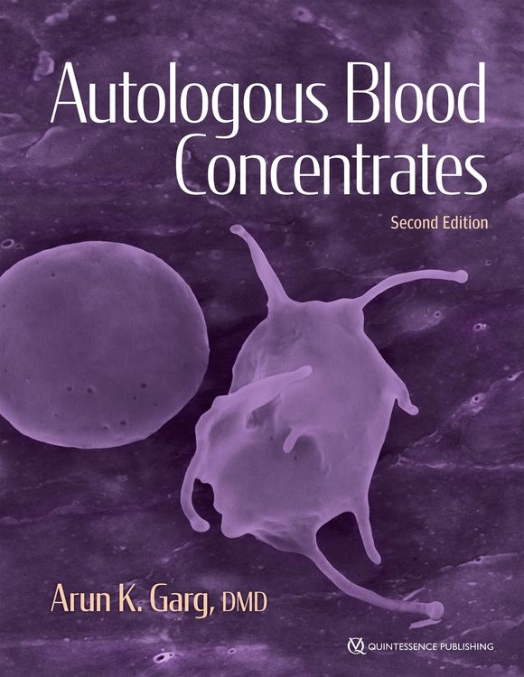 Produktbild: Autologous Blood Concentrates