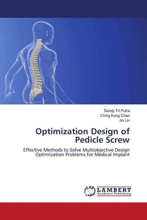Produktbild: Optimization Design of Pedicle Screw
