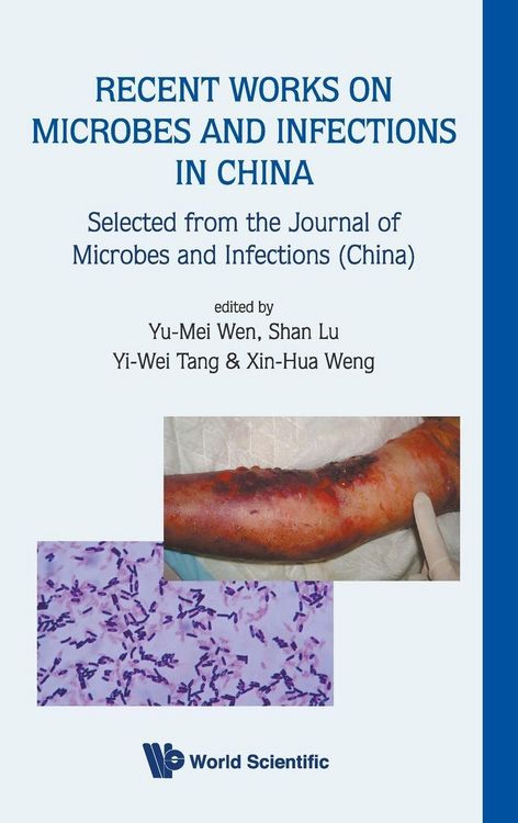 Produktbild: Recent Works On Microbes & Infections...