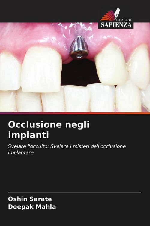 Produktbild: Occlusione negli impianti
