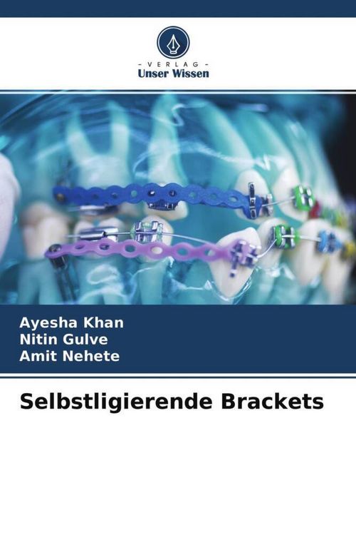Produktbild: Selbstligierende Brackets