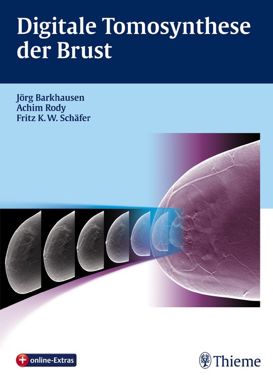 Produktbild: Digitale Tomosynthese der Brust