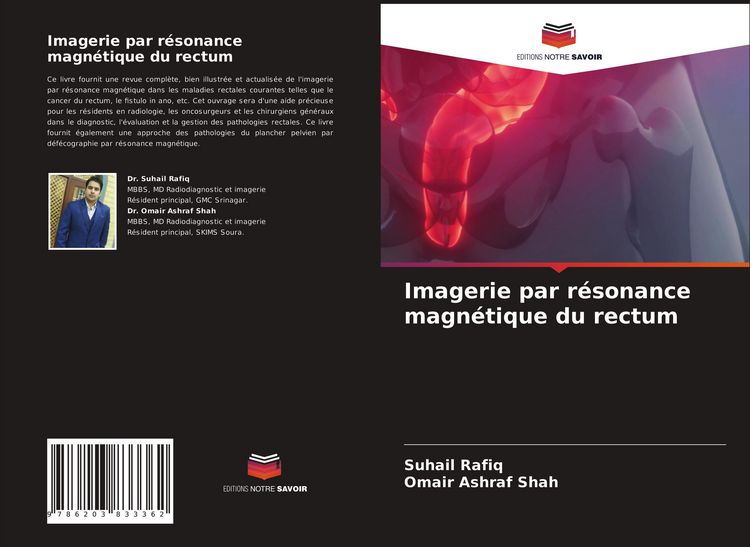Produktbild: Imagerie par r&eacute;sonance magn&eacute;tique du rectum