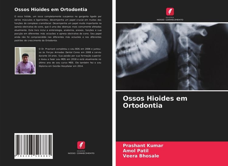Produktbild: Ossos Hioides em Ortodontia