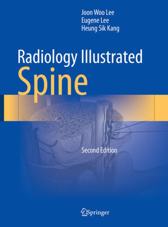 Produktbild: Radiology Illustrated: Spine