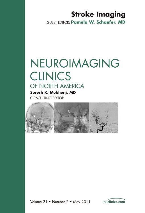 Produktbild: Stroke Imaging, an Issue of Neuroimaging Clinics
